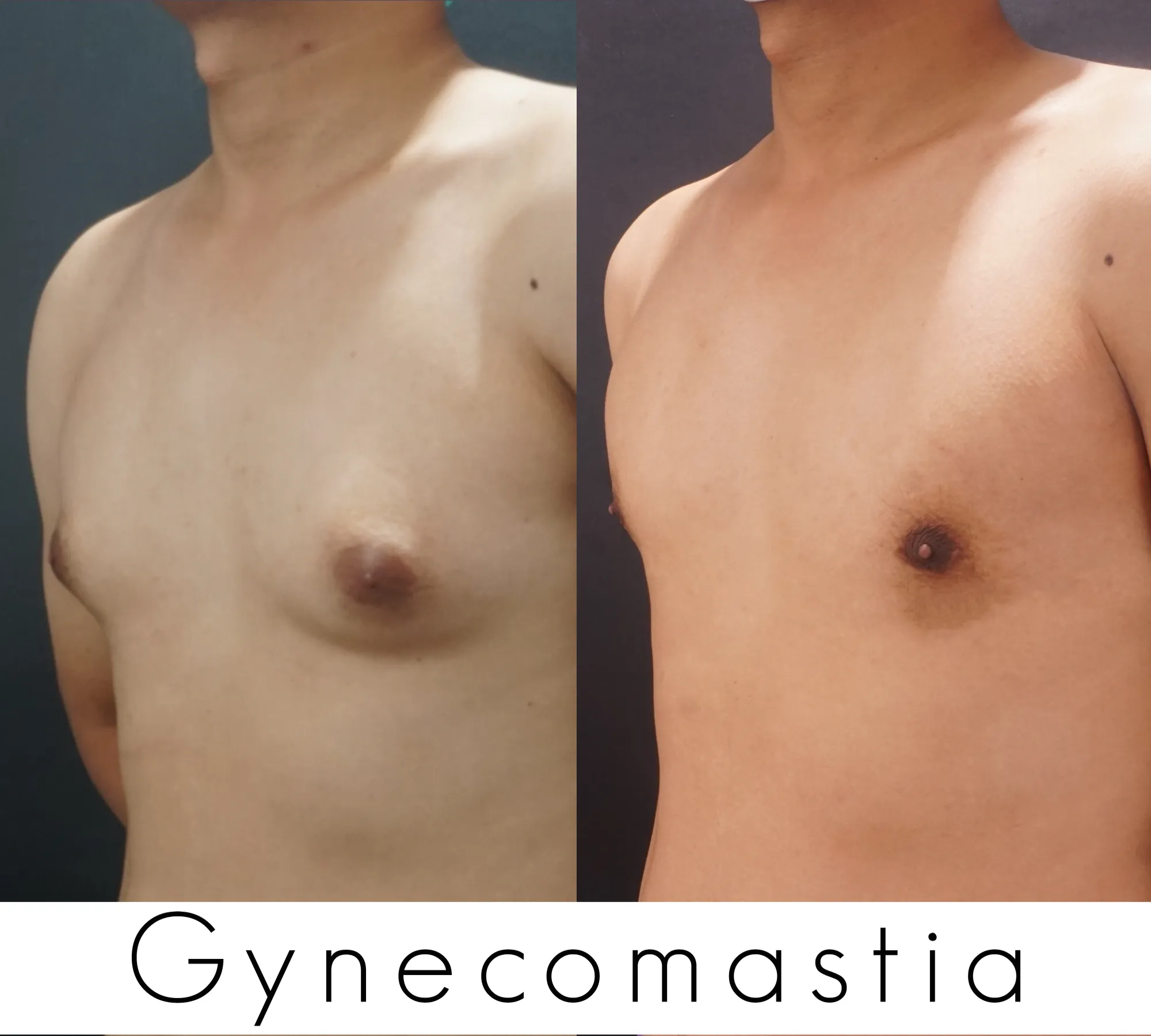 WENDHA SINAGA 3 - case 45